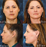 Los Angeles Ear Nose Throat Doctors