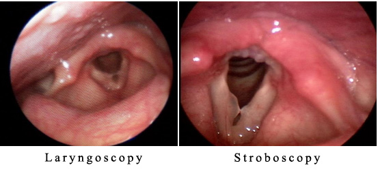 Los Angeles Otolaryngolofy