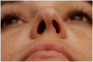 Read more about the article Septoplasty and the Voice