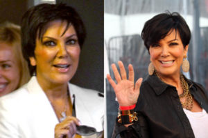 Read more about the article Did Kris Jenner’s Facelift Change Her Eyes?