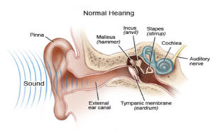 Read more about the article Acoustic Trauma: How Loud Noises Can Damage Hearing