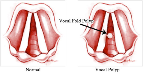 Nathan Sykes Vocal Surgery