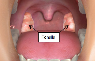 pandas ocd strep infection