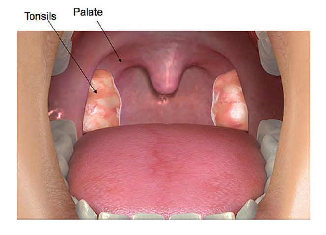 pediatric ent los angeles