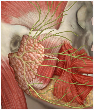 Figure 2: The facial nerve can be affected by inflammation due to a herpes zoster oticus infection. Facial nerve damage can potentially result in facial distortion.