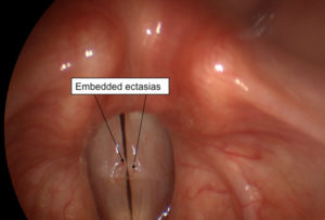 Read more about the article Voice Case of the Week: The Value of a (Healthy) Screening Exam