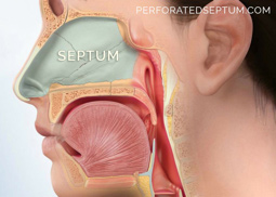Figure 1: Schematic representation of the nasal cavity including the septum.