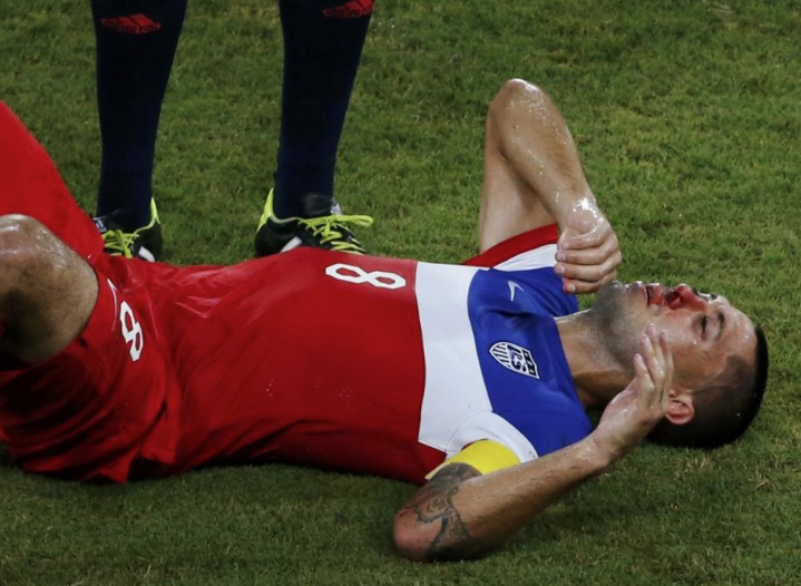 An injured Dempsey on the field immediately after sustaining a nasal fracture.