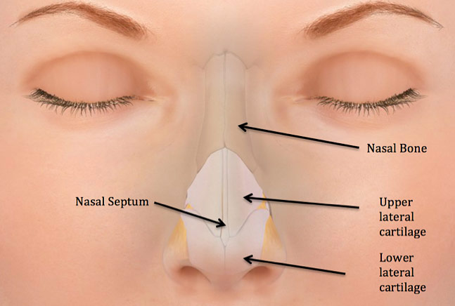 Figure 1: Nasal trauma commonly results in fractures of the delicate nasal bones as well as bruising, displacement, or perforation of the underlying nasal septum.
