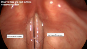 Read more about the article Voice Case of the Week: Larynx Injury from Inhalation