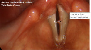 Read more about the article Voice Case of the Week: Who Needs a Laryngeal Surgeon?