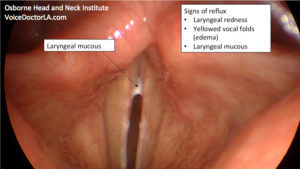 Read more about the article Voice Case of the Week: Sometimes it is Reflux