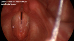 Read more about the article Voice Case of the Week: The Effects of Alcohol on the Voice