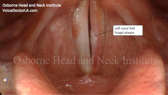 Figure: Patient 2 before treatment.