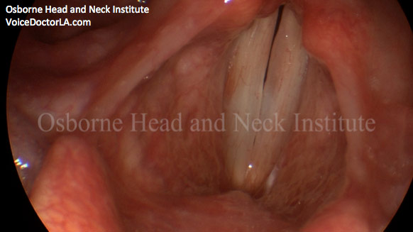 Figure: Patient 2 after treatment.