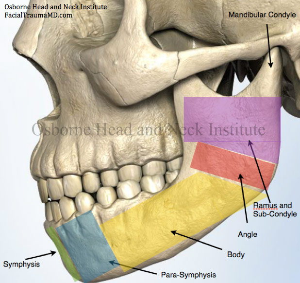 Figure 1: This figure displays different regions of the mandible (lower jawbone).