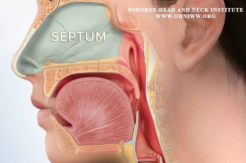 epistaxis-treatment