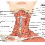 Voice Pain and Muscle Tension Dysphonia