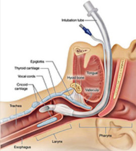 Read more about the article Surgery and Your Voice