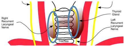 voice-surgery2