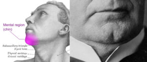 Read more about the article Chin Implants on the Rise