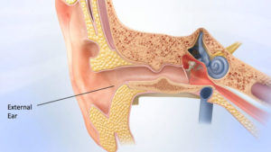 Read more about the article Risks of Surgery for Surfer’s Ear
