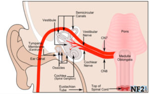 Read more about the article Hearing Restoration Surgeries for Congenital Microtia