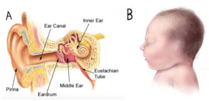 Read more about the article Congenital Anotia and Its Repair